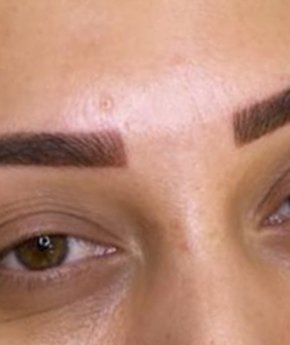 Mix Teknik Kaş Uygulaması